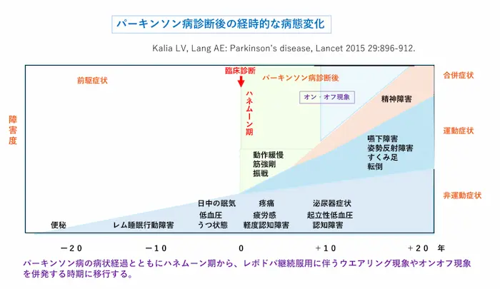リハビリテーション勉強会資料：パーキンソン病診断後の経時的な病態変化のグラフ。ハネムーン期からウェアリングオフ・オンオフ現象へ移行する