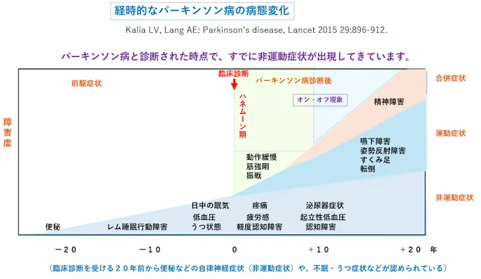 リハビリテーション勉強会資料：経時的なパーキンソン病の病態変化のグラフ。診断された時点ですでに非運動症状が出現している