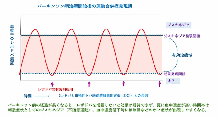 リハビリテーション勉強会資料：パーキンソン病治療開始後の運動合併症発現期のグラフ。ジスキネジア発現閾値とオフ症状