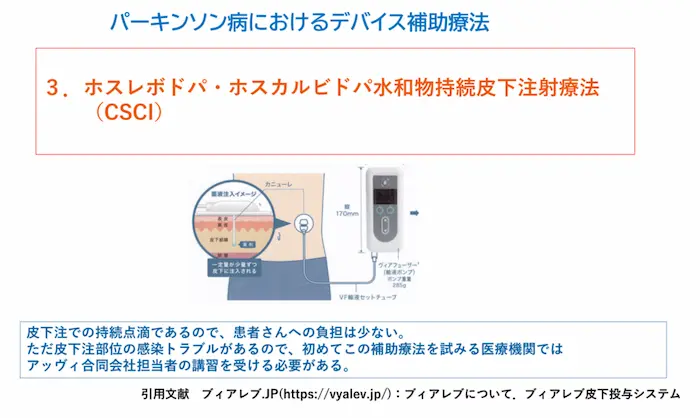 リハビリテーション勉強会資料：デバイス補助療法3 ホスレボドパ・ホスカルビドパ水和物持続皮下注射療法（CSCI）