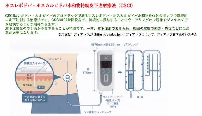 リハビリテーション勉強会資料：ホスレボドパ・ホスカルビドパ水和物持続皮下注射療法（CSCI）の解説と、輸液ポンプの図