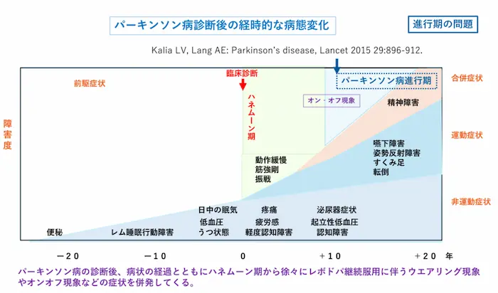 リハビリテーション勉強会資料：パーキンソン病診断後の経時的な病態変化のグラフと、進行期の問題